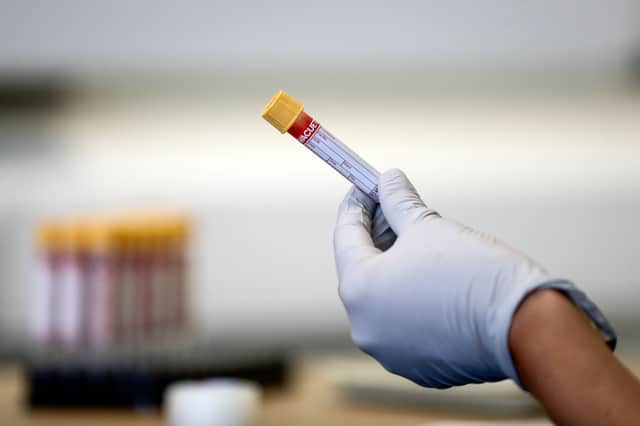 A paramedic holds a test tube containing a blood sample during an antibody testing programme (Photo by SIMON DAWSON/POOL/AFP via Getty Images)