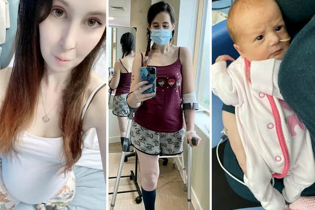 A pregnant mum bravely chose to have her leg amputated to save her unborn baby when she was diagnosed with cancer (image: SWNS/Kathleen Osborne)