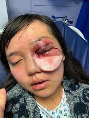 The youngest victim in one of the attacks was left with severe facial injuries