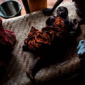 A sick baby is seen at a makeshift paediatric health centre as an outbreak of malaria hit an African village (Picture: Getty Images)