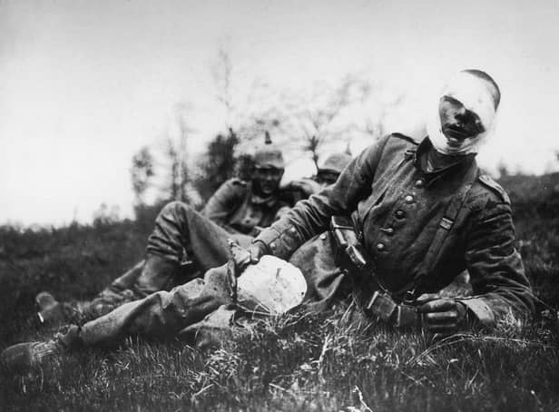 <p>A wounded German soldier, 18 May 1915 (Photo: Hulton Archive/Getty Images)</p>