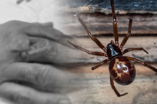 A man has spoken of how he nearly lost his finger after being bitten by a false widow spider (Image: Kim Mogg/JPIMedia)