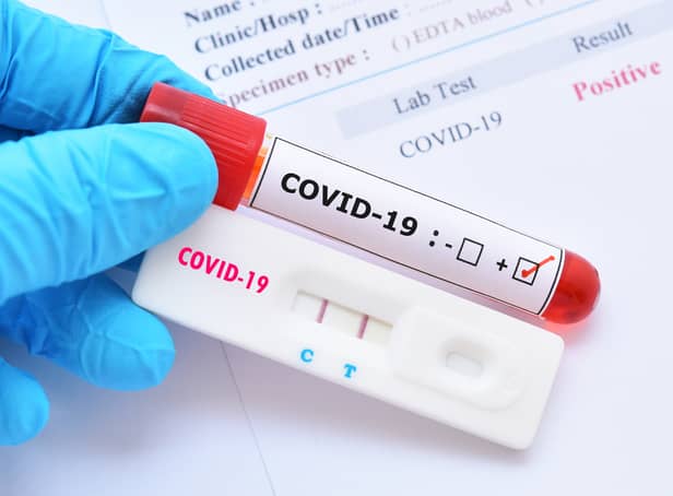 <p>Some people infected with Covid-19 don’t experience any symptoms of the virus (Photo: Shutterstock)</p>