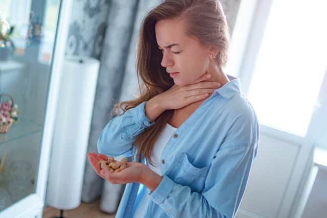 Peanut allergy sufferers can risk becoming very unwell if they come into contact with even the tiniest dose of peanut (image: Shutterstock)
