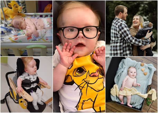 One-year-old Theo Greenhall has spinal muscular atrophy (Pictures: SWNS)