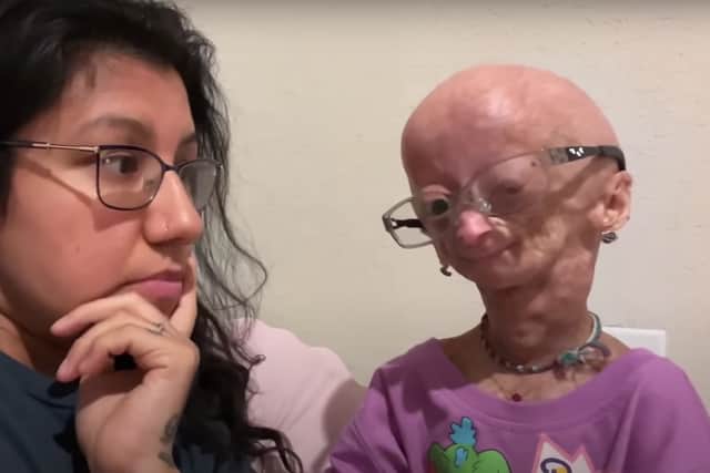 In one of her last videos, Adalia Rose revealed she had had a mystery illness (image: Adalia Rose/YouTube)