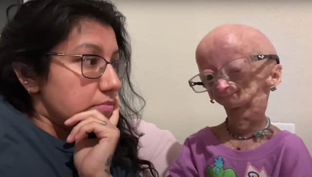 In one of her last videos, Adalia Rose revealed she had had a mystery illness (image: Adalia Rose/YouTube)
