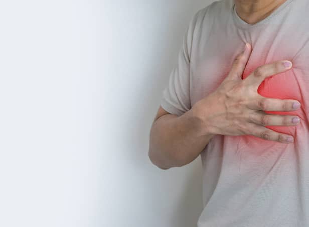 <p>Early symptoms of a heart attack include sweating and anxiety. (Picture: Adobe)</p>