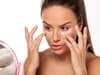 Best foundations for rosacea 2022: What is the skin condition and make-up to help cover it and care for skin