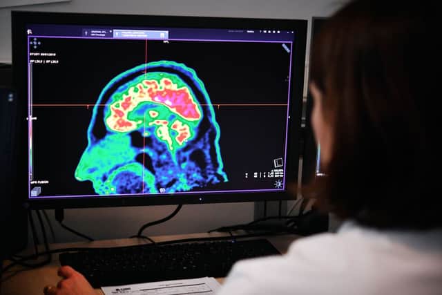 The idea that the left or right side of your brain can be more dominant is entirely a myth (Photo: FRED TANNEAU/AFP via Getty Images)