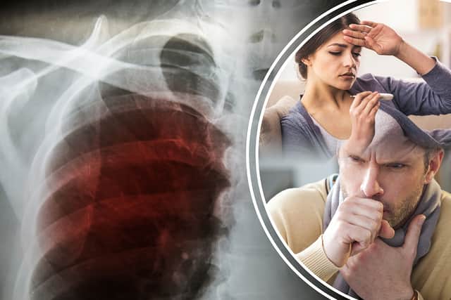 Tuberculosis mainly affects the lungs and can cause a persisten cough (Composite: Kim Mogg / JPIMedia)