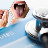 Symptoms in the mouth could be a sign of diabetes (Composite: Kim Mogg / JPIMedia)