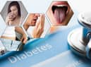 Symptoms in the mouth could be a sign of diabetes (Composite: Kim Mogg / JPIMedia)