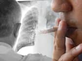 All current and ex-cigarette smokers are being urged to take up invitations for lung cancer check-ups (Composite: Mark Hall / JPIMedia)