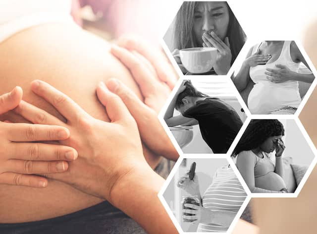 Pregnancy can cause an array of symptoms and can vary from person to person (Composite: Mark Hall / NationalWorld)