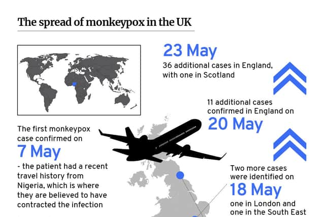 The first monkeypox infection in England was confirmed on 7 May 2022 