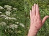 Giant hogweed: where poisonous plant is found in UK, how to identify it and how to treat burns