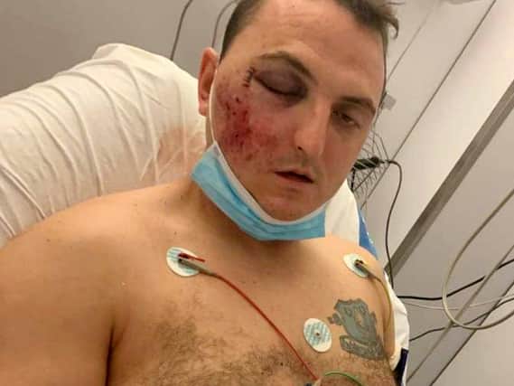 Steen Nodwell was holidaying in Spain when he was chased by a group of men and attacked (Photo: Bethan Nodwell / SWNS)