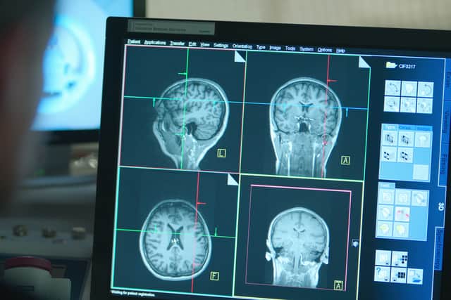 An image of a brain scan on a monitor, indicating what a brain looks like on drugs (Credit: Netflix)