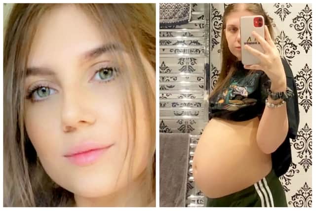 Hollie Welham, 21, thought she was pregnant, but it was an ovarian cyst which grew to be the size of a football.