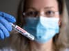 Is there a test for monkeypox? How to test for virus, and new 90-minute PCR test in development explained
