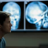 Chris Pratt as James Reece, sat in front of an MRI scan result (Credit: Justin Lubin/Amazon Prime Video)