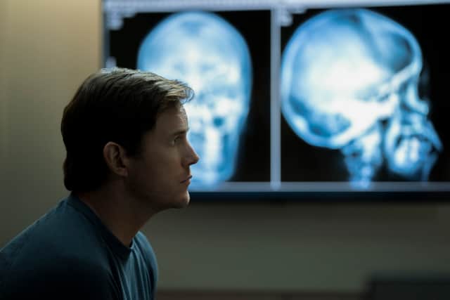 Chris Pratt as James Reece, sat in front of an MRI scan result (Credit: Justin Lubin/Amazon Prime Video)