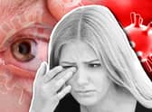 Some people have reported problems with their eyesight post-infection (Composite: Mark Hall / NationalWorld)