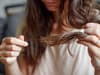 Long Covid symptoms: hair loss and reduced sex drive among wider long-term health effects, study finds