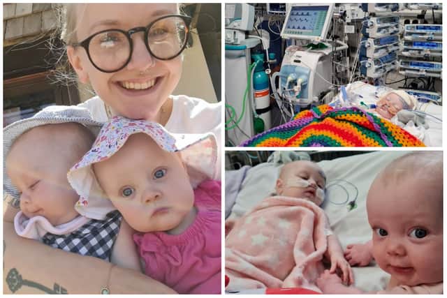 Seven-month-old baby Aurelia - who is an identical twin - underwent complex heart surgery and spent more than a week sedated last month.