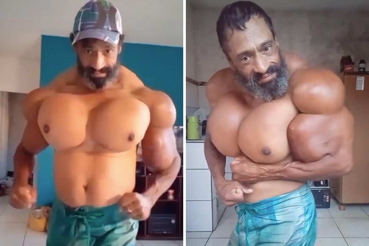 Who was Valdir Segato? Brazilian Hulk known for injecting muscles with  Synthol dies aged 55