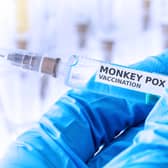 Monkeypox is caused by a similar virus to smallpox and the MVA vaccine should give a good level of protection against monkeypox