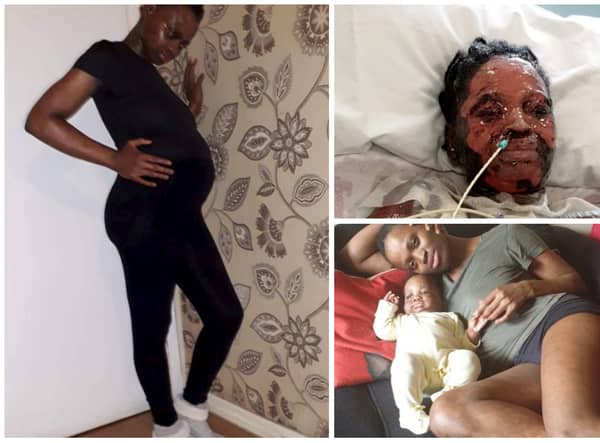 Soraia Bonuar Gomes, 30, was taking naproxen and cyclizine and just eight weeks into her pregnancy was rushed to ICU with a potentially life-threatening skin condition.