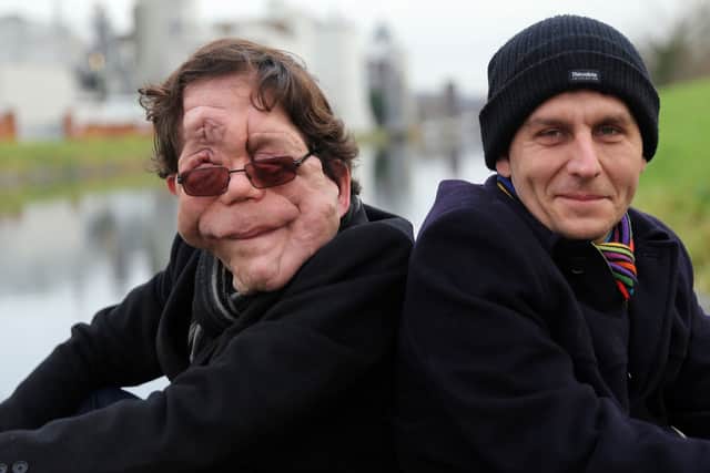 Adam and Neil Pearson starred in the BBC documentary Horizon: My Amazing Twin together (Photo: BBC/James Newton)