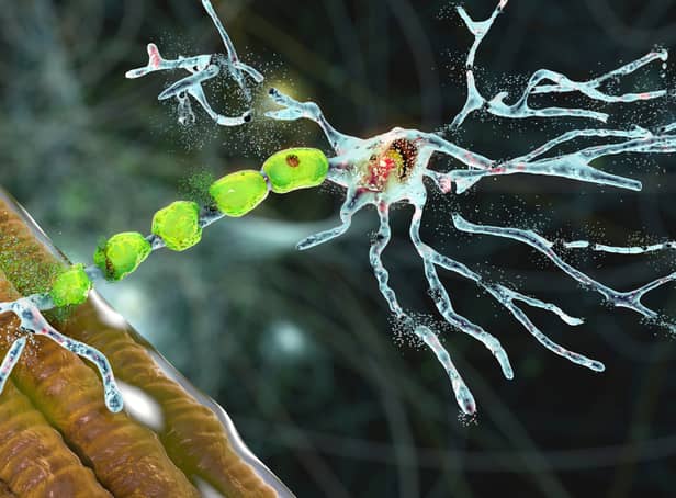<p>Degradation of motor neurons, conceptual 3D illustration. (Kateryna_Kon - stock.adobe.com)</p>