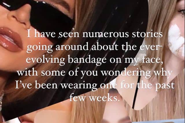 Khloe took to Instagram to address the speculation surrounding her bandages. (Photo Credit: Instagram / @khloekardashian)