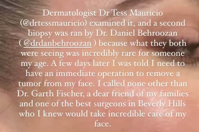 Khloe explains the process she followed from meeting dermatologists to getting a biopsy. (Photo Credit: Instagram / @khloekardashian)
