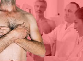 Although the exact cause of breast cancer in men is not known, there are some things that increase your risk of getting it