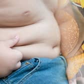 The National Child Measurement Programme annually measures the height and weight of children in England