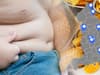 Child obesity: 16 areas in England with the highest rate of children living with severe obesity