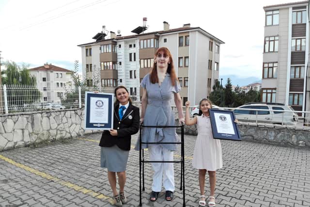 Rumeysa Gelgi holds the Guinness World Record for being the tallest woman in the world (Pic: PA)