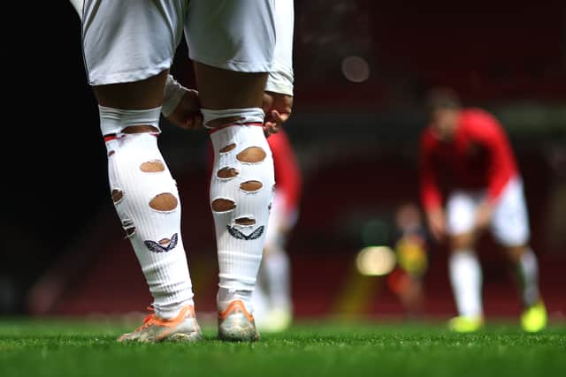 A footballer with holes in his socks. (Photo by Alex Pantling/Getty Images)