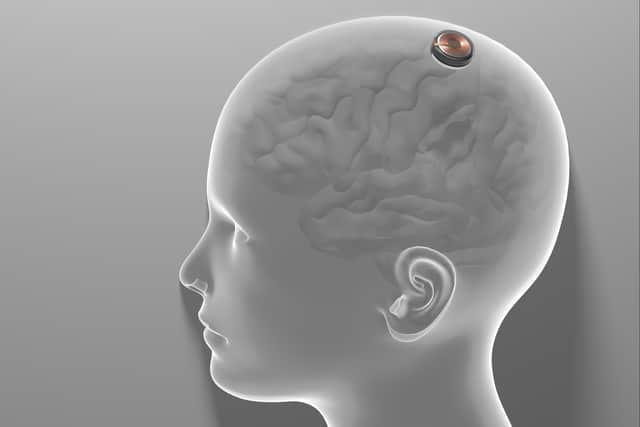 Elon Musk’s Neuralink brain chip could help people regain their sight (image: Adobe)