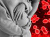 What is Strep B? Is it a risk for pregnant women, can it be passed to babies, what to do if you’re worried