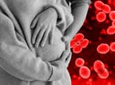 Strep B is common in pregnant women and rarely causes any problems, according to the NHS