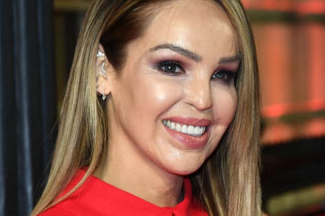 Katie Piper attends The Sun Military Awards 2020 at Banqueting House on February 06, 2020 in London, England. (Photo by Gareth Cattermole/Getty Images)