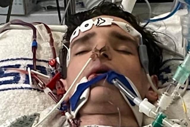 Jack Hollingsworth, 19, was rushed to hospital with severe flu (Photo: BCUHB / SWNS)