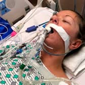 Amanda Stelzer’s vaping addiction left her on  life support suffering a life-threatening lung condition (Photo: Amanda Stelzer / SWNS)