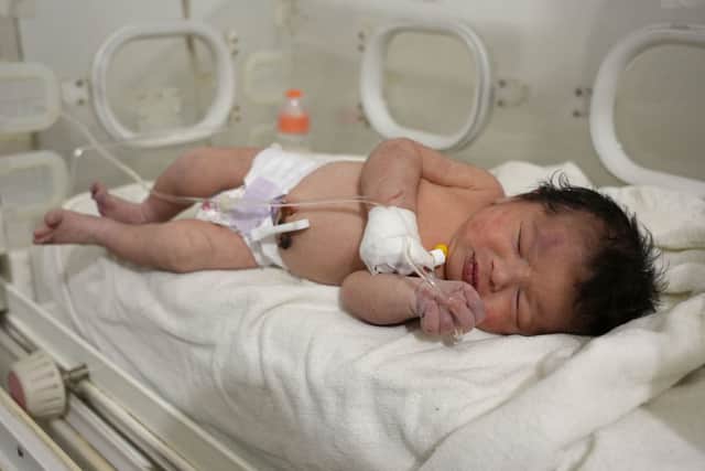 Baby Aya was found still tied by her umbilical cord to her mother when she was pulled alive from the rubble of a home in northern Syria following the deadly earthquakes (Photo by RAMI AL SAYED/AFP via Getty Images)