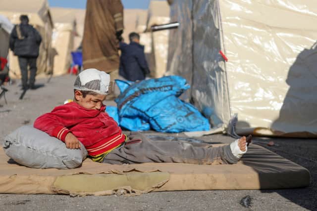 An injured Syrian child rests at a makeshift shelter for people who were left homeless, near the rebel-held town of Jindayris (AFP via Getty Images)